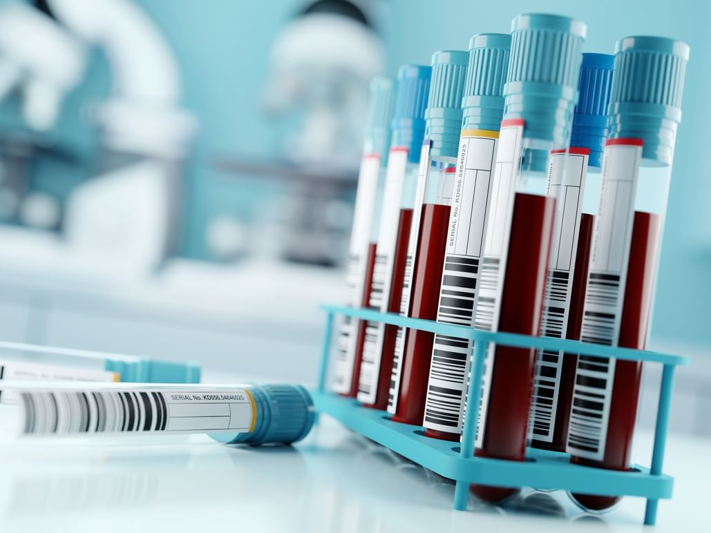 Abu Dhabi introduces non-invasive liquid biopsy test for colorectal cancer screening