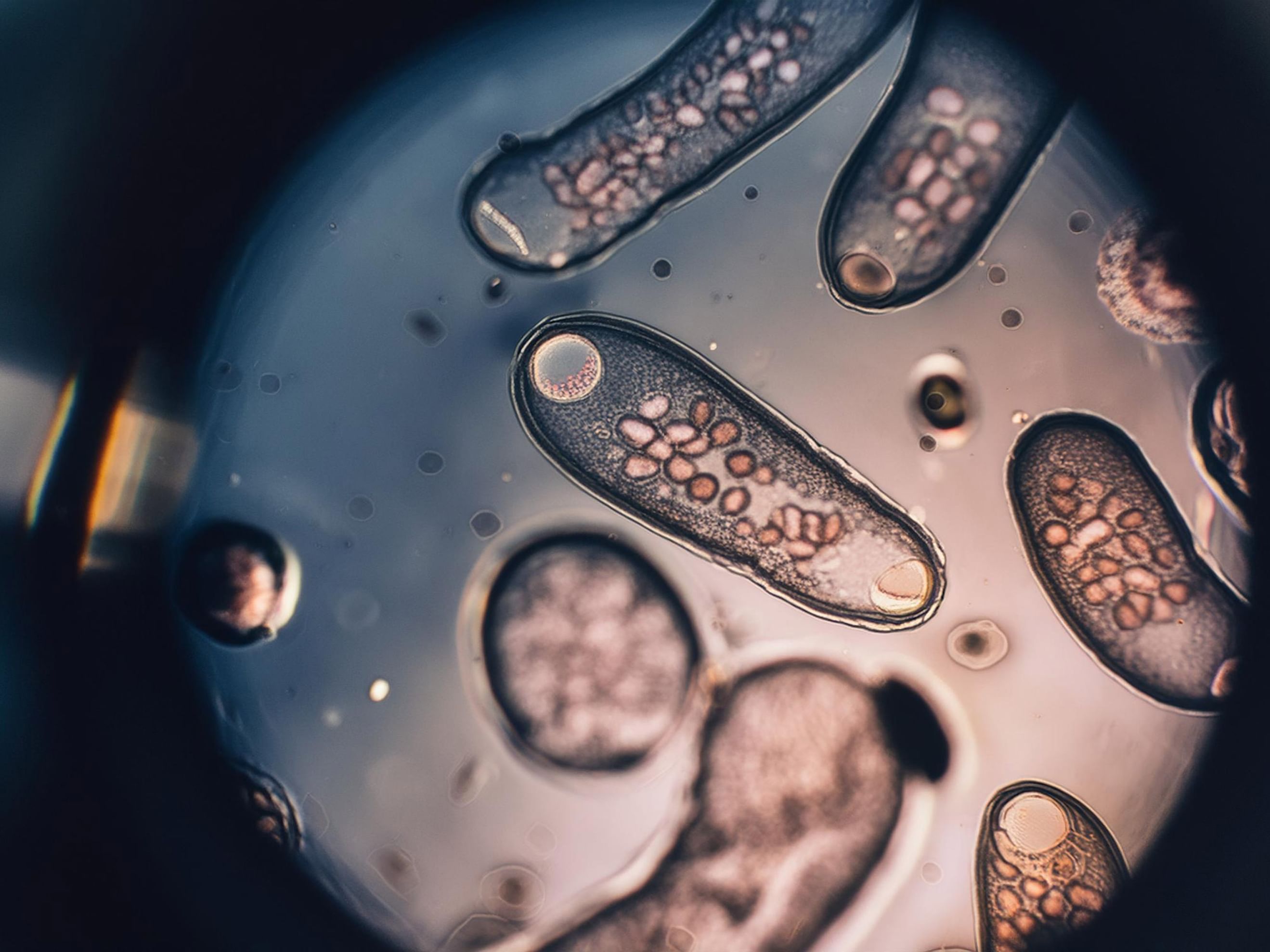 Outbreak of parasite infection grows to over 1,000 cases in Michigan