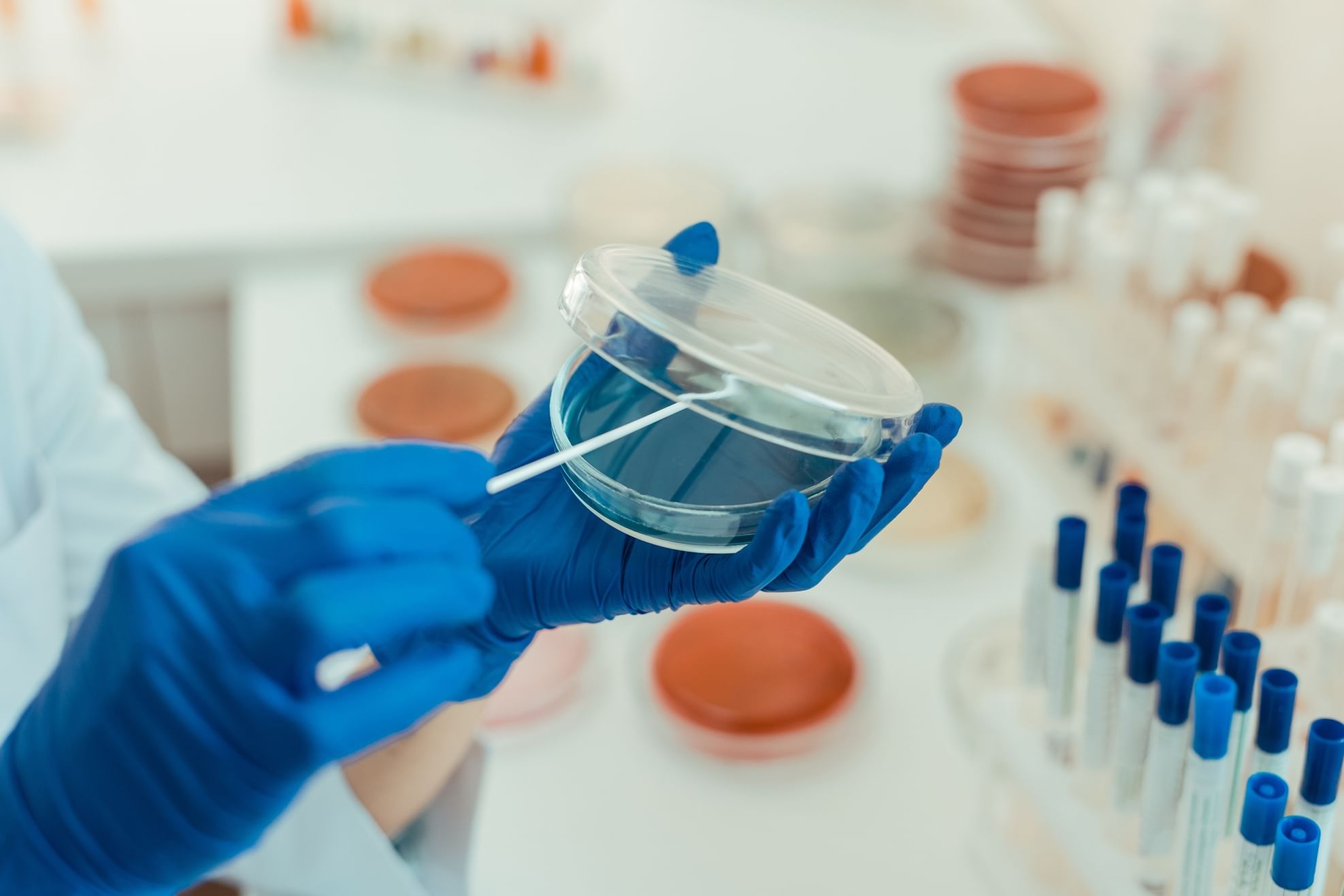 NMSS awards funding to 4 research projects driving multiple sclerosis research