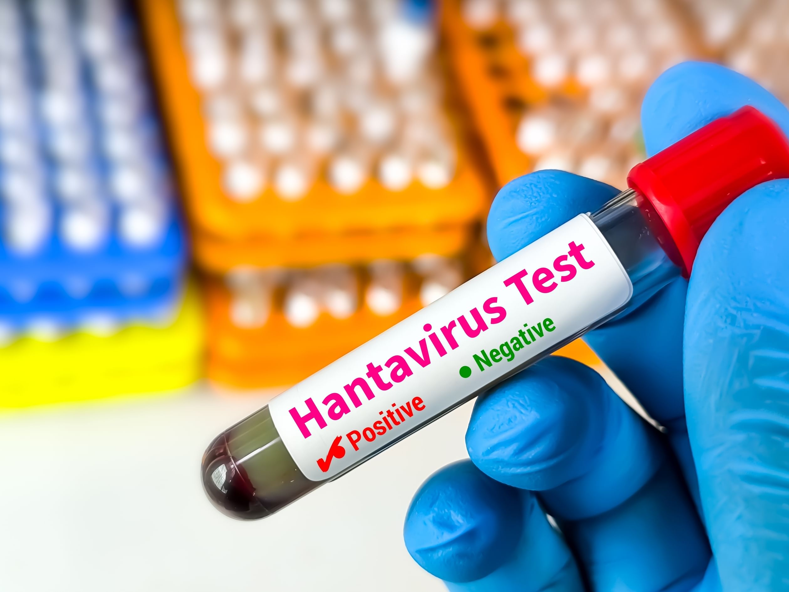 Spanish government confirms new case of Hantavirus