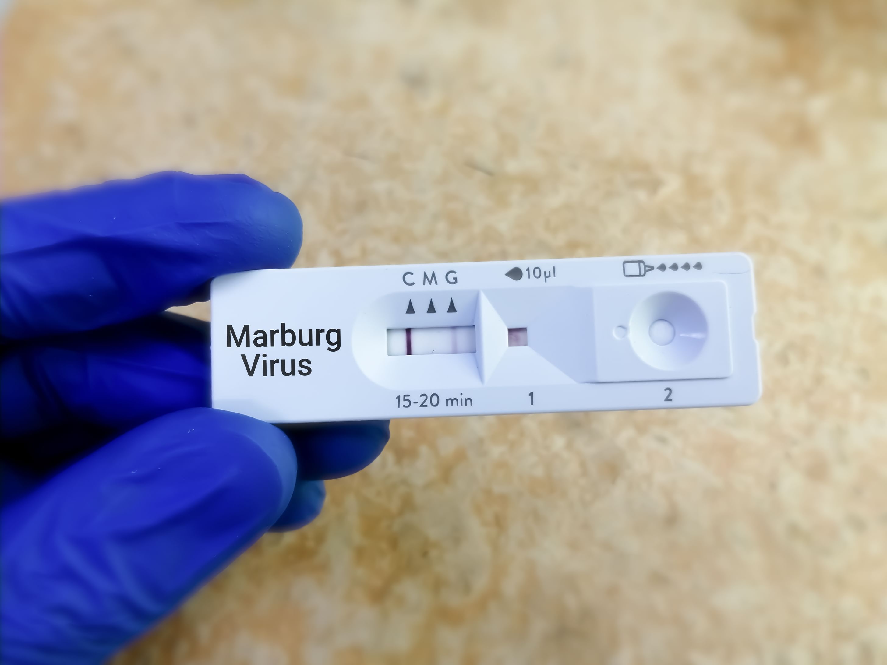 Ethiopia declares end of Marburg virus disease outbreak