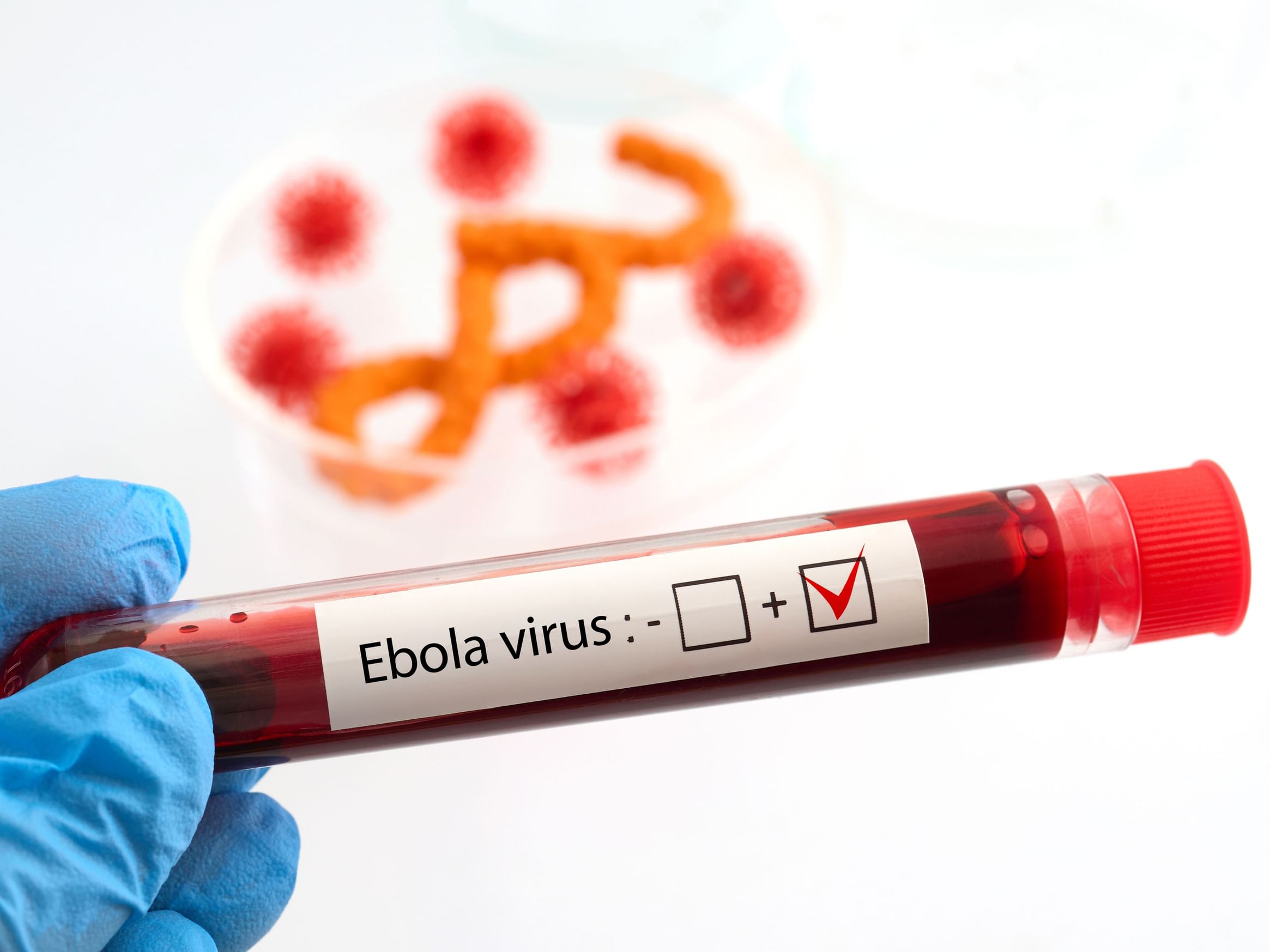 France reports Ebola case in doctor returning from Congo